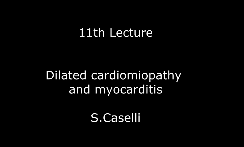 Dilated cardiomiopathy and myocarditis S.Caselli