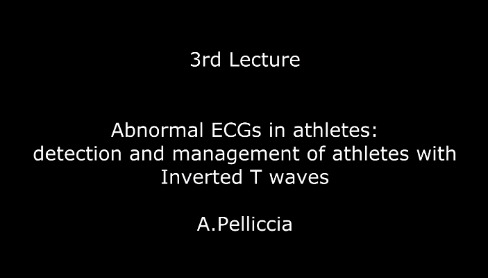 Abnormal ECGs in athletes: detection and management of athletes with Inverted T waves. A.Pelliccia