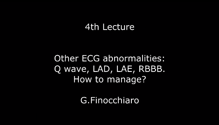Other ECG abnormalities: Q wave, LAD, LAE, RBBB. How to manage? G.Finocchiaro